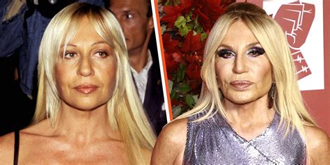 donatella versace lifting|Donatella Versace .